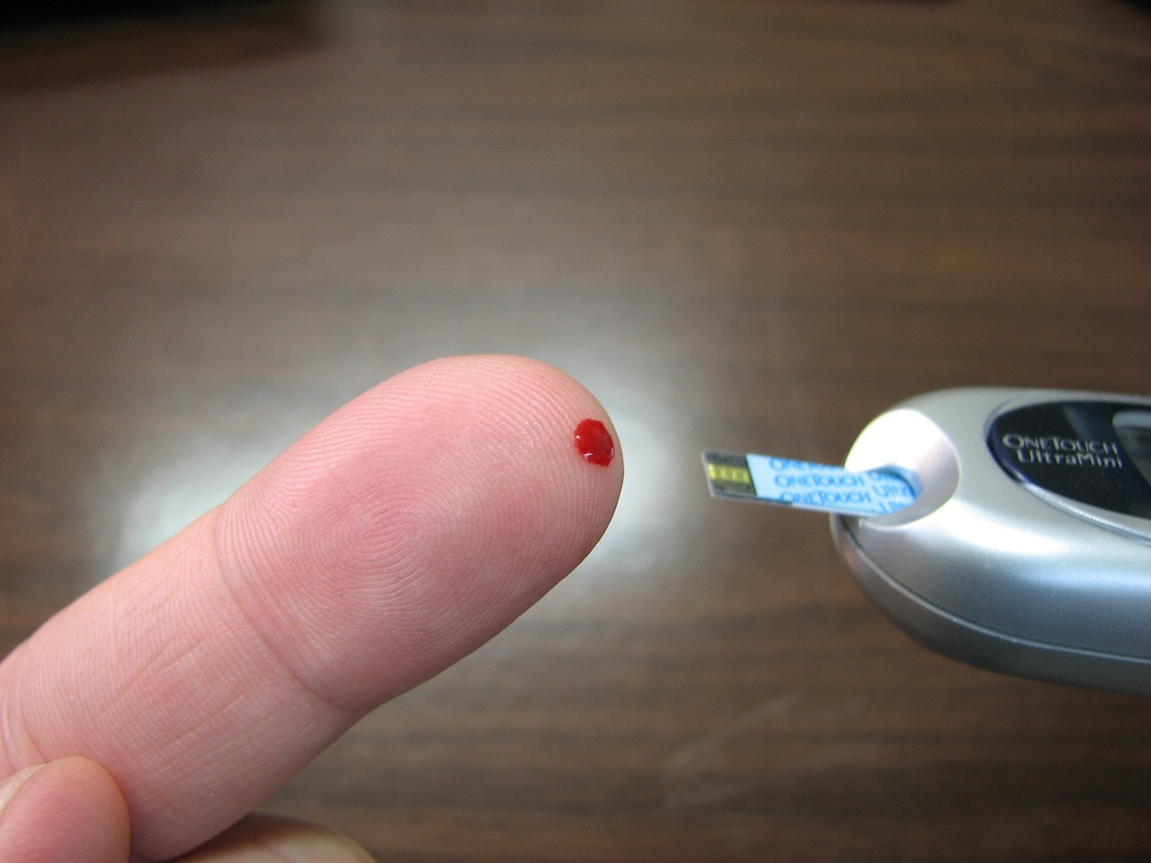 甲状腺检查须知，是否需要空腹？一篇文章为你解惑。